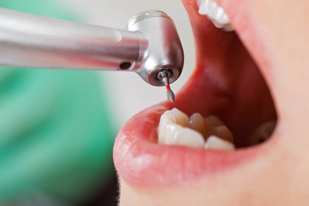 Best Pediatric Emergency Dentist in Winnie, TX